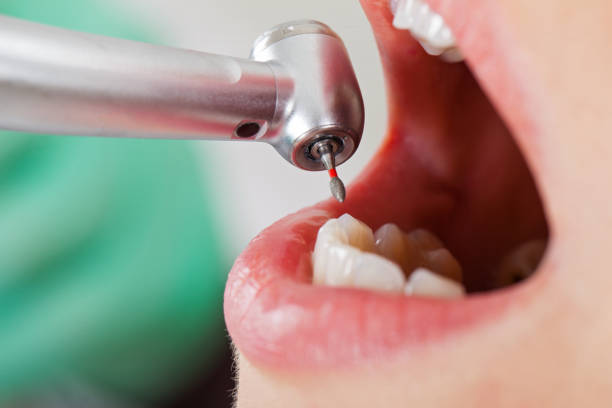 Best Emergency Treatment for Oral Infections in Middlebranch, OH